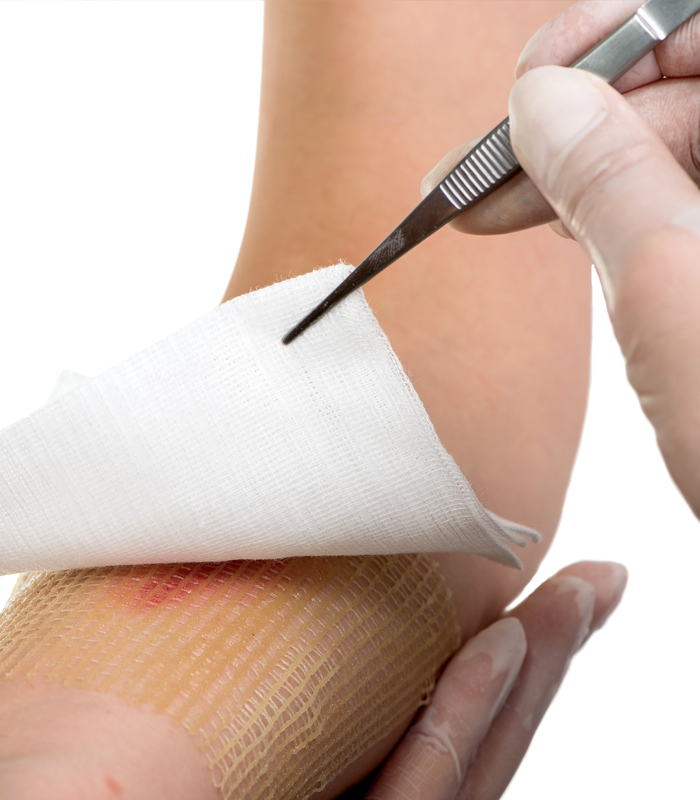 Wound Care